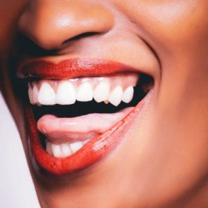 white teeth