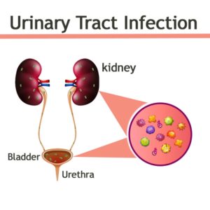 Urinary tract infection