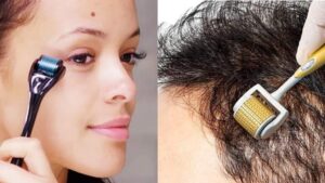 Derma roller