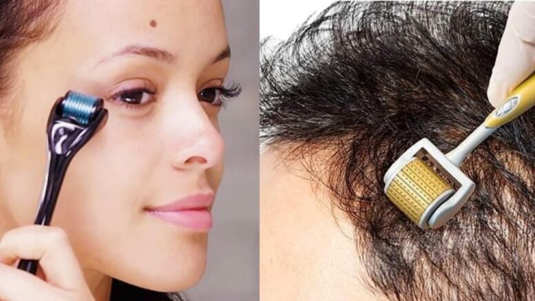 Derma roller